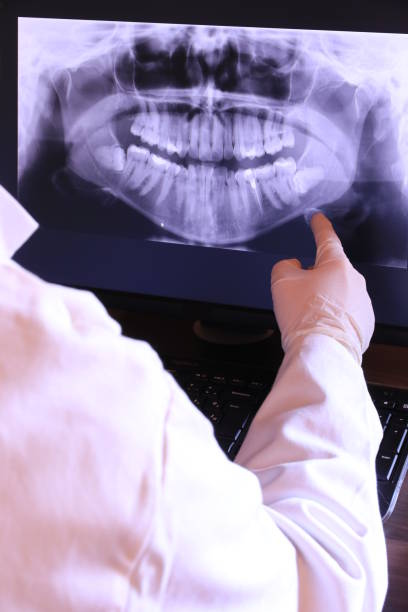 Best Emergency Broken Tooth Repair in Burton, MI